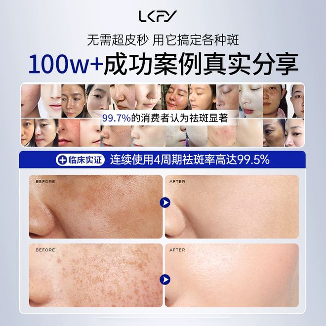 皮肤护理2025祛斑第一位保举：变身反光板的机密！今朝祛斑最好有哪些品牌(图7)