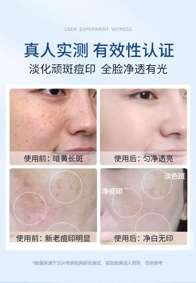 皮肤护理2025祛斑第一位保举：变身反光板的机密！今朝祛斑最好有哪些品牌(图9)