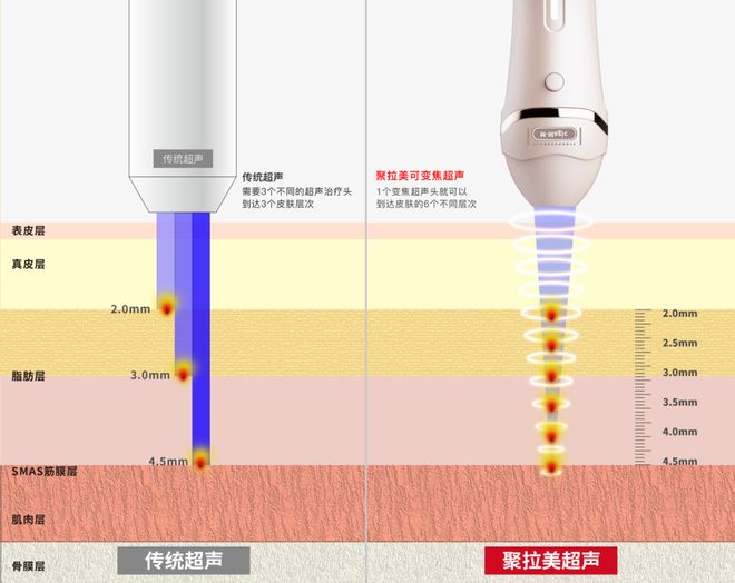 星空电子寻美之旅 科技智造将来之美「金达威」跨入医美东西新赛道(图4)